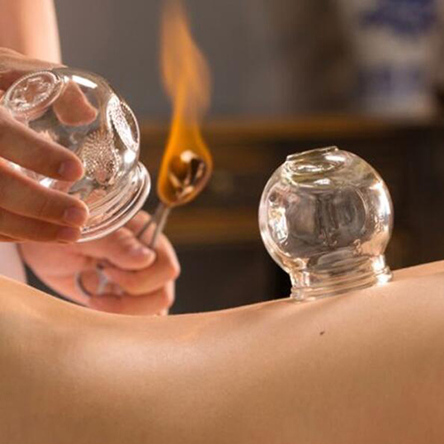 Cupping massage Therapy