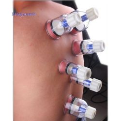 Rotarcy cupping set